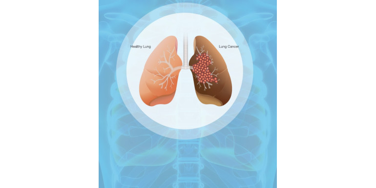 CBD a choroby układu oddechowego