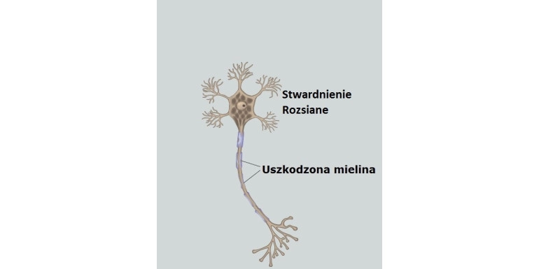 Stwardnienie Rozsiane oraz Choroba Parkinsona 